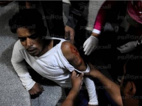 demonstrators_injured_during_clashes_outside_muslim_brotherhood_headquarter_in_muqattam_30_june_2013